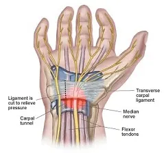 carpal-tunnel-median-nerve