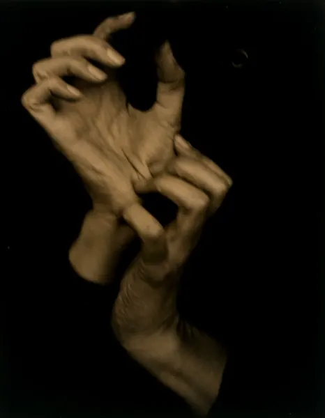 expensive wrist pain photo